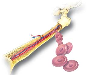 Leucemia aguda, a doença dos glóbulos brancos