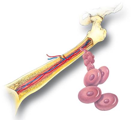 Leucemia no sangue